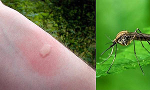 Что делать если расчесал укус комара